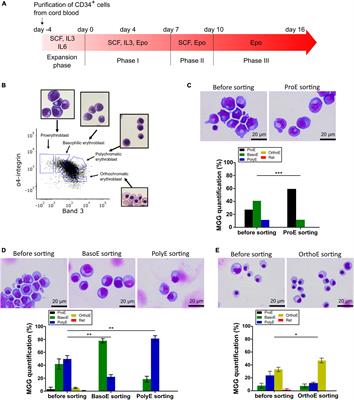 Transmission Electron Microscopy to Follow Ultrastructural Modifications of Erythroblasts Upon ex vivo Human Erythropoiesis